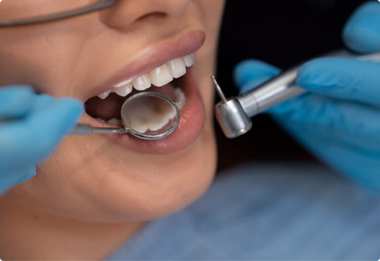 Dental Implants: Everything You Need to Know Before Getting the Procedure